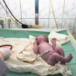 What Is Delayed Cord Clamping And How Is It Beneficial