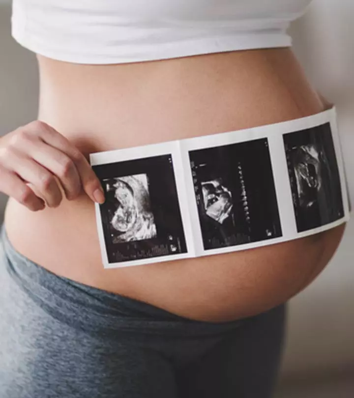 8 Scary Things Your Baby Does During An Ultrasound That Are Totally Normal
