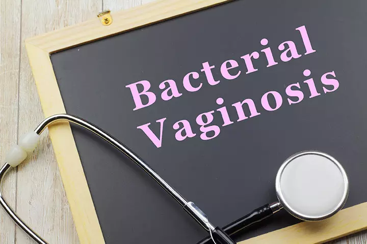 Bacterial Vaginosis Bacterial Vaginosis