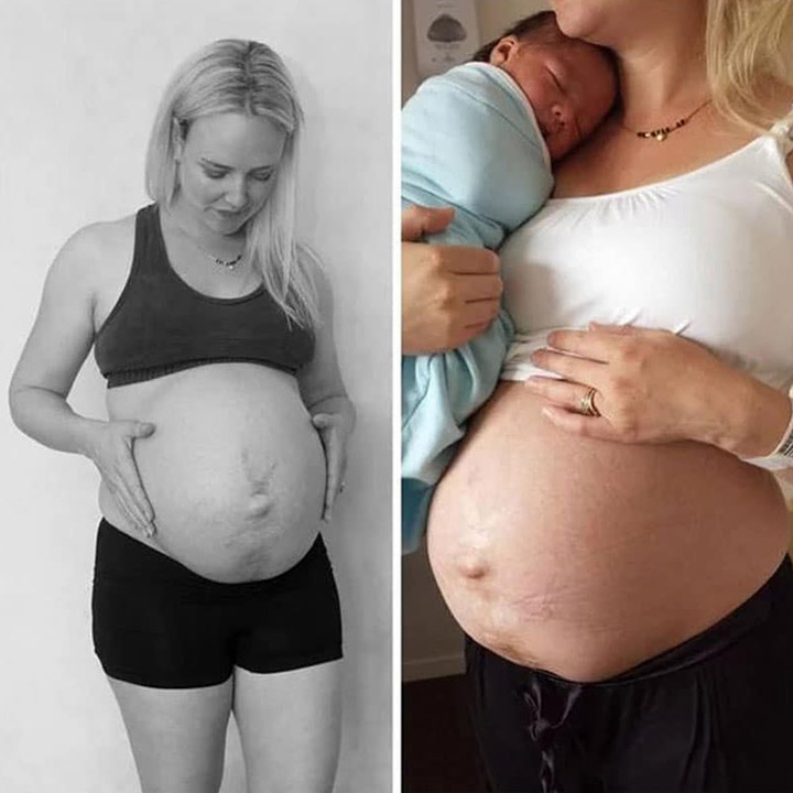 Before And After 36-Week Pregnant And 24 Hours Post Childbirth