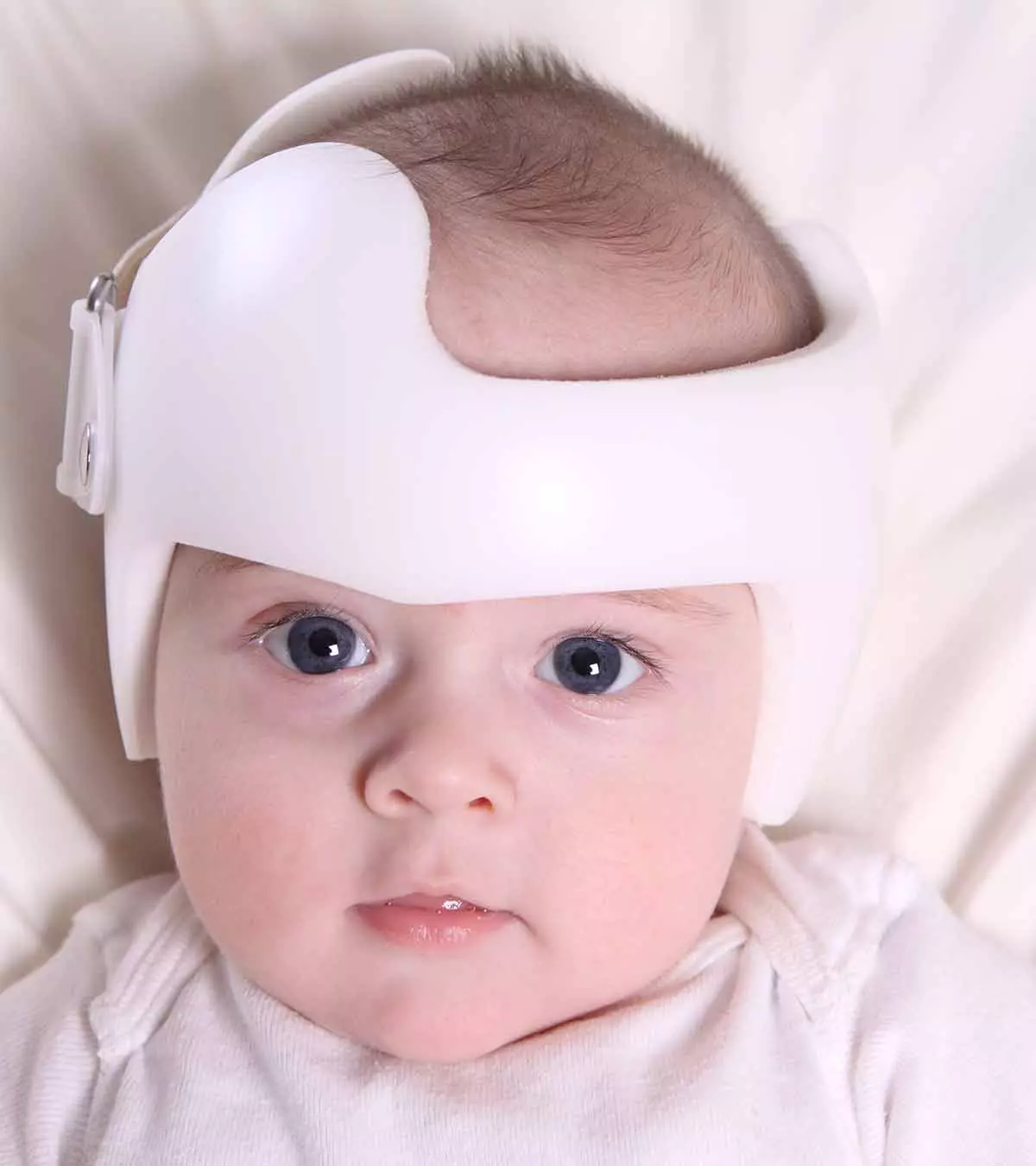 Baby Wearing A Corrective Helmet