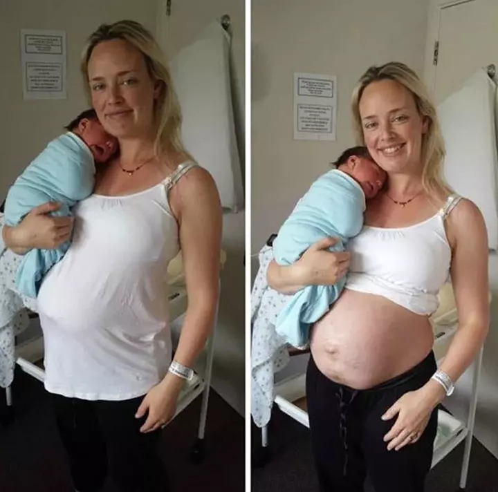 Just Two Days After Her Baby Was Born Just Two Days After Her Baby Was Born