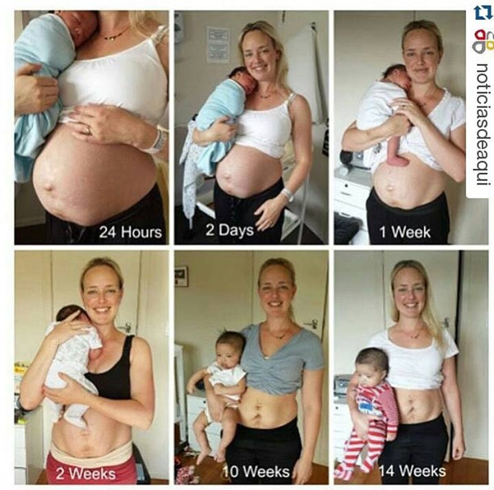 Postpartum Baby Bump Pictures Show The Reality Of Pregnancy1