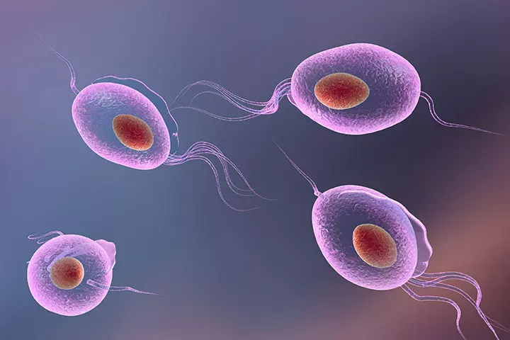 Trichomoniasis Trichomoniasis