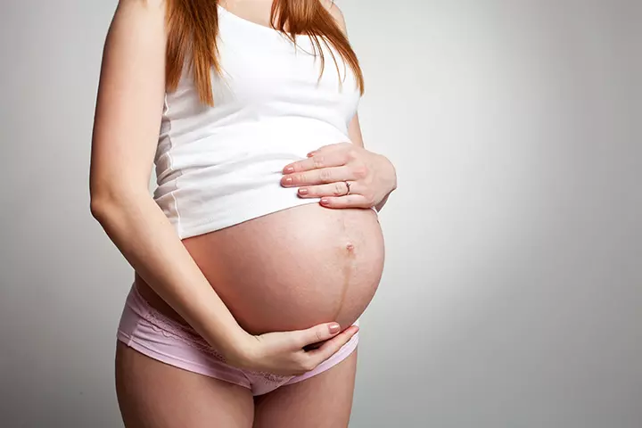 Causes Of Stretch Marks