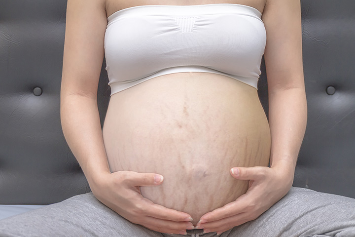 I Don’t Have A Single Stretch Mark Post-Delivery And Here’s My Secret1
