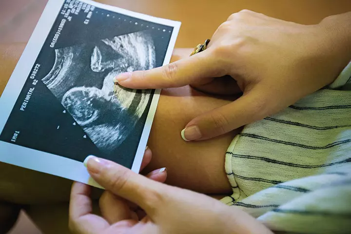 Labour Calls For Ban On Early Foetus Sex Test1