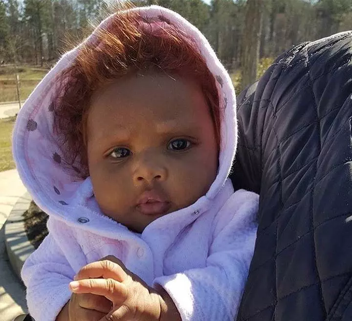 The Little Red Hair In A Hood