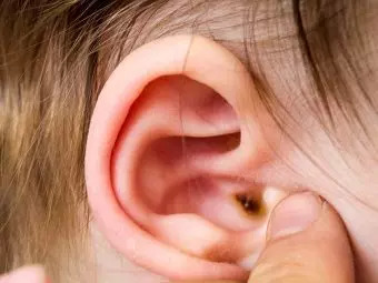 How To Clean Baby Earwax? Effective Tips And Home Remedies