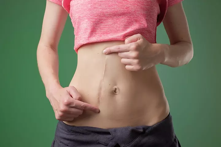 Abdominal Pain And Soreness