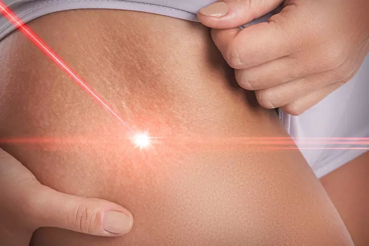 How To Get Rid Of Them