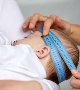 Macrocephaly In Babies: Possible Causes, Diagnosis & Treatment