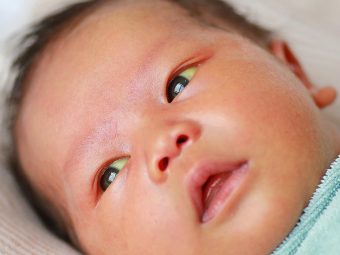 Biliary Atresia (BA) In Newborns: Causes, Symptoms And Treatment