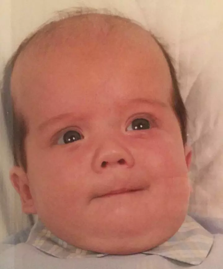 Too Young For Hair Fall Nah!