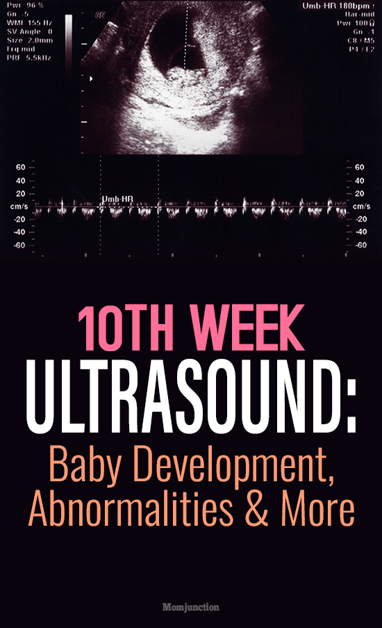 10th Week Baby Development: What’s Happening Inside the Womb