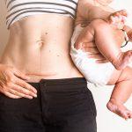 After Cesarean Delivery Recovery