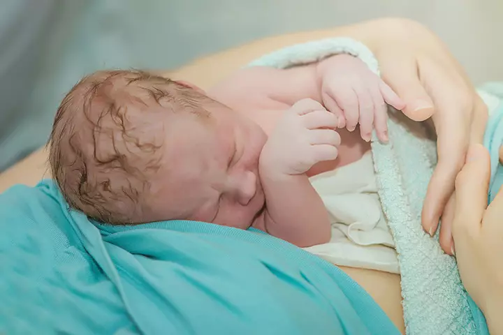 Breech Birth
