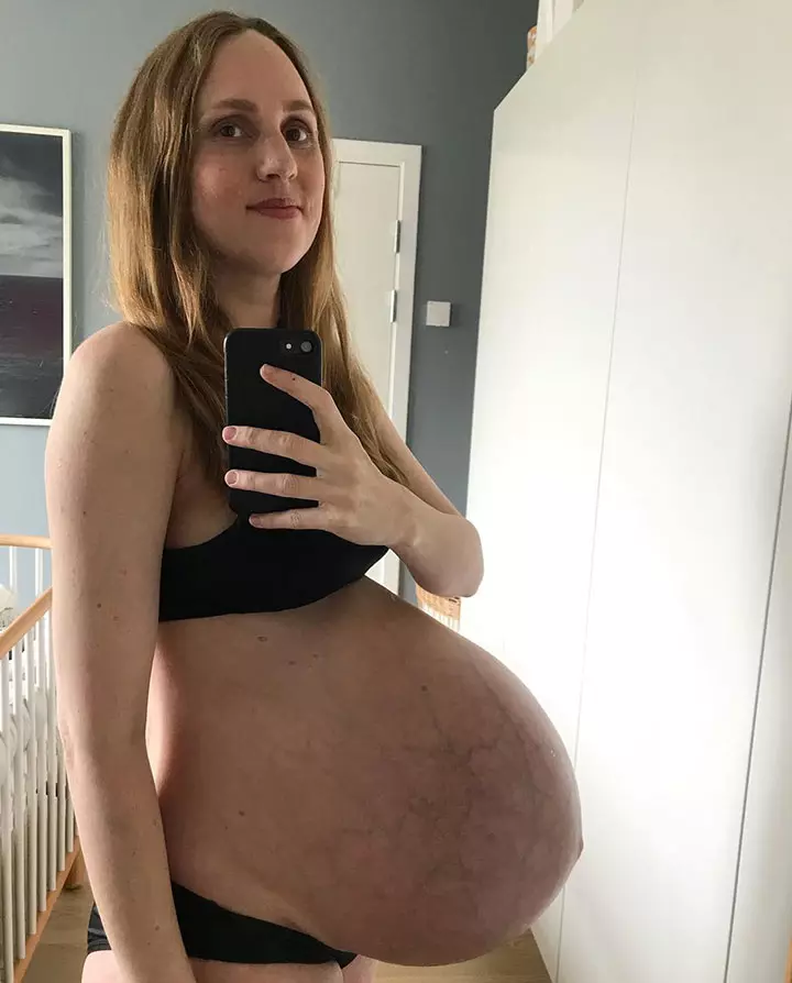 Mother Of Triplets Shows Reality Of Postpartum Body A Month After Giving Birth