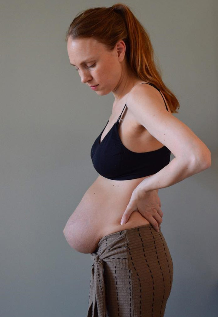 Mother Of Triplets Shows Reality Of Postpartum Body A Month After Giving Birth
