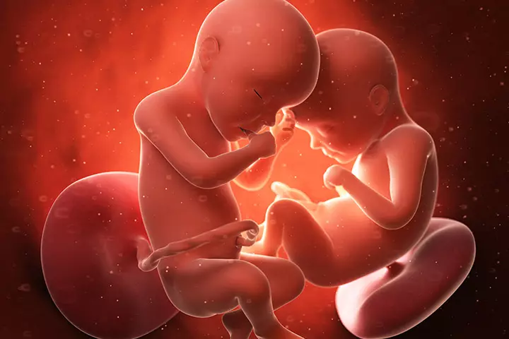 Multiple Pregnancies