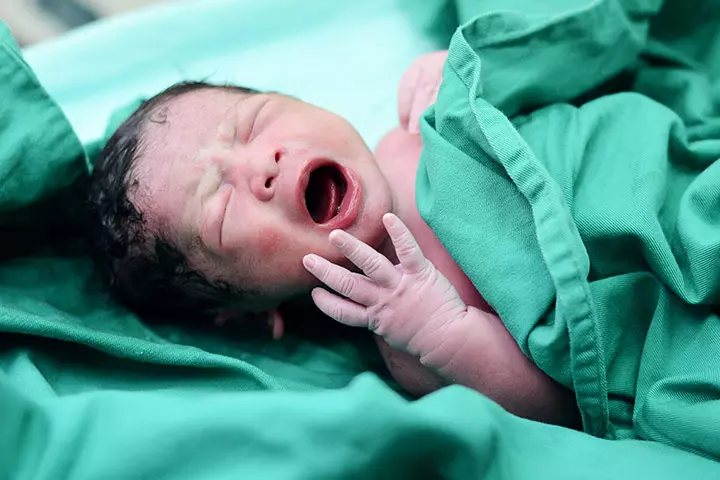 The Moms-To-Be Have Had A Cesarean Earlier
