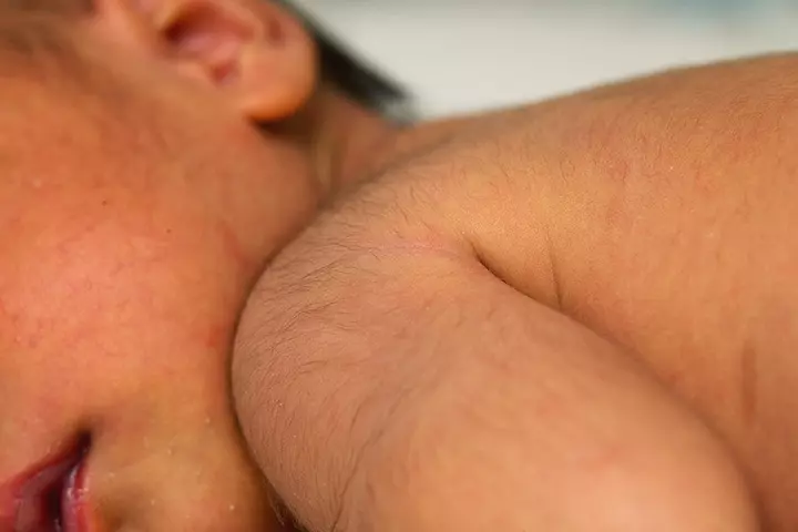 They'll Have Fine Hair All Over The Body