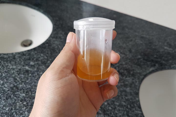 It is easy to detect the hCG levels in the early morning urine
