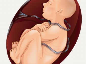 What Is A Nuchal Cord? Causes, Diagnosis, And Management