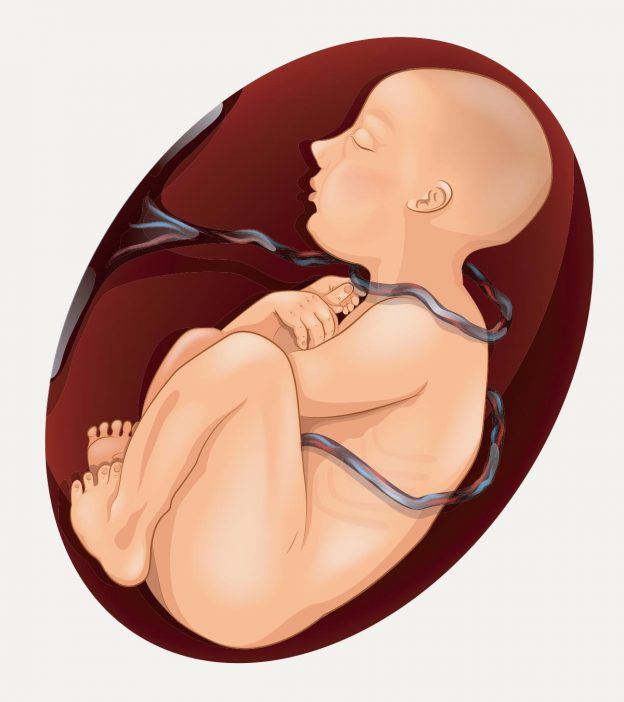 What Is A Nuchal Cord? Causes, Diagnosis, And Management