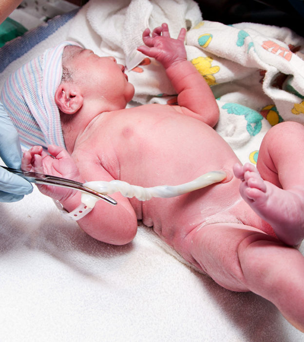 The Truth About Nuchal Cords (Umbilical Cord Around Baby’s Neck)