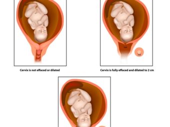 Cervix Dilation Chart: Signs, Stages And Procedure To Check