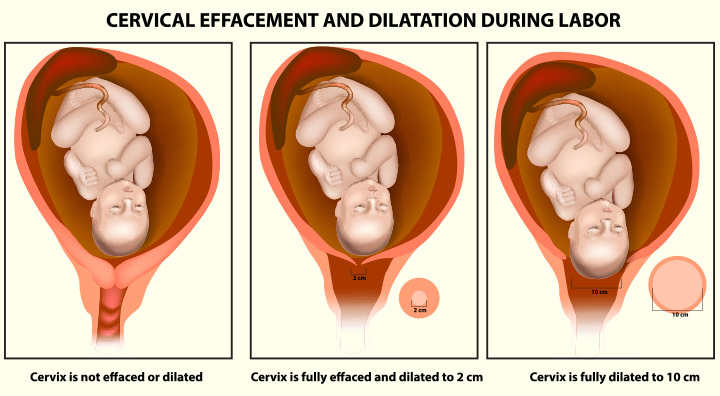 Dilation For Birth Chart