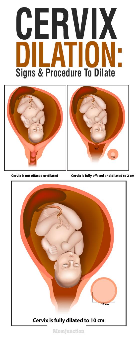 Can You Feel Your Cervix Dilate In Early Pregnancy