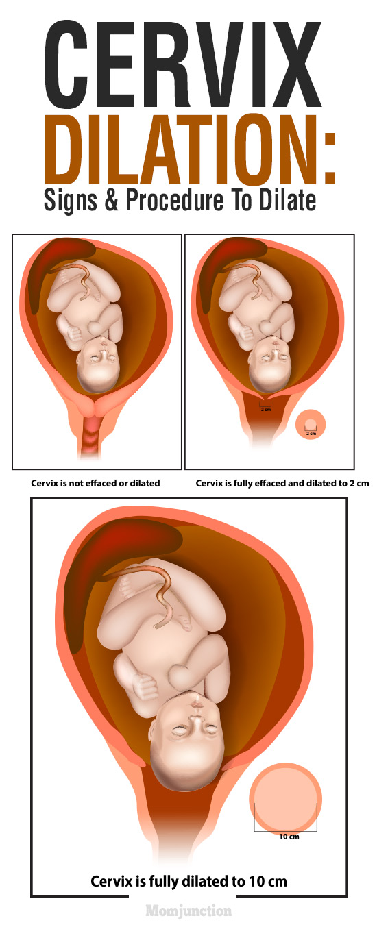 Cervix Dilation Signs And Procedure To Dilate