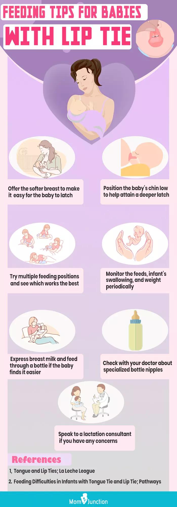 feeding tips for babies with lip tie (infographic)