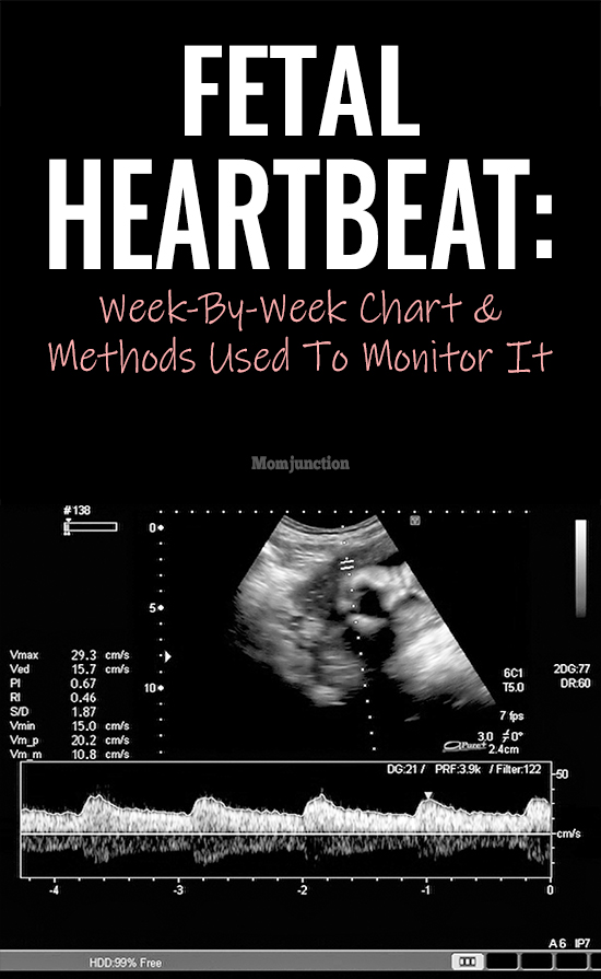 Fetal Heartbeat WeekByWeek Chart And Methods Used To