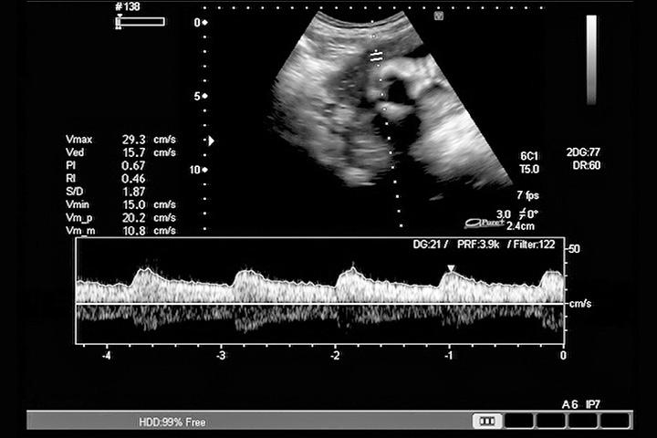 Baby heart rates