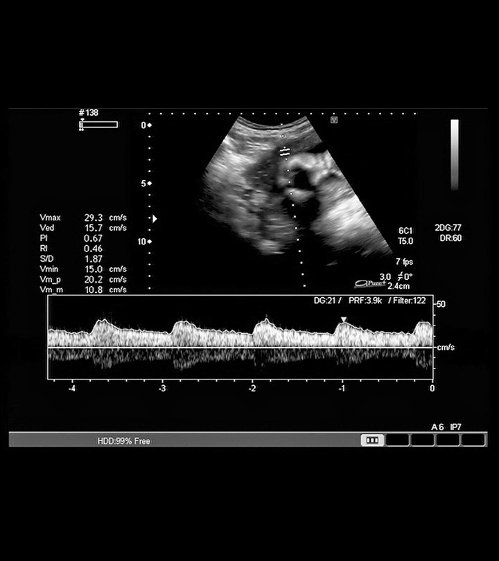heart beat rate of baby boy during pregnancy