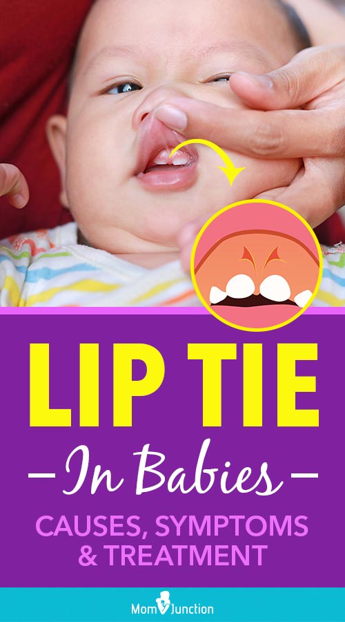 baby lip quiver 2 months