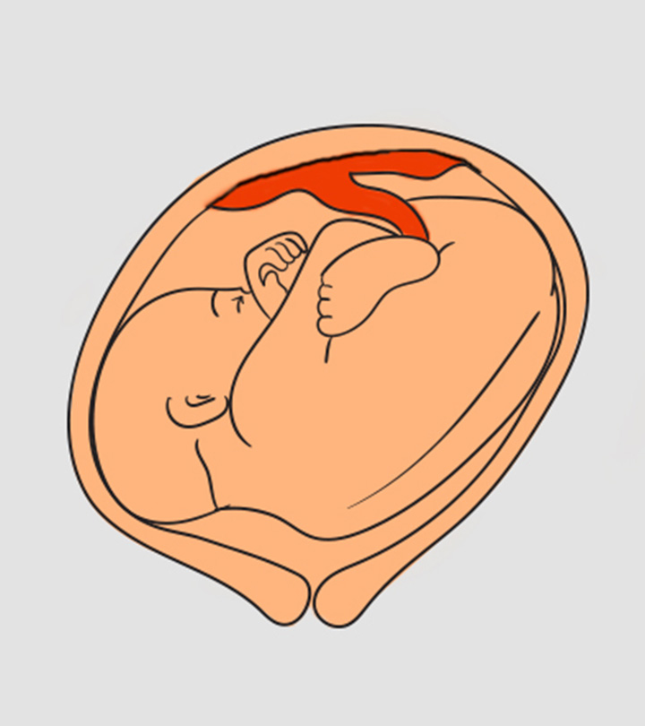 5 Ways To Turn A Baby From Transverse Lie Position