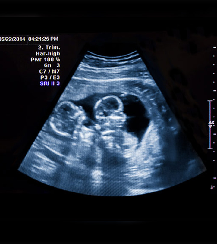 双胞胎的视频s 'Fighting' Inside Mother's Womb During Ultrasound Is Going Viral