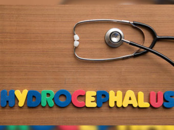 What Causes Hydrocephalus In Babies, Adults, And The Elderly?