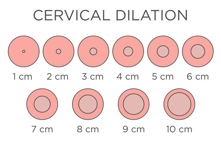 Cervix dilation starts from 1 cm and grows to 10 cm, complete dilation