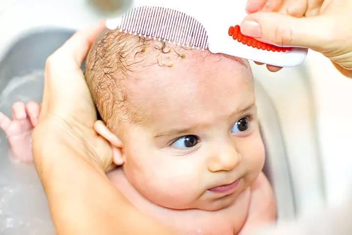 Cradle Cap