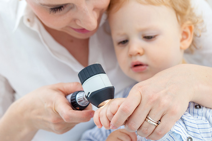 How To Get Your Baby Tested For Allergy