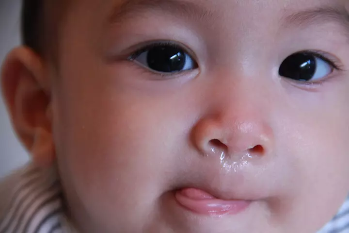 Runny Nose