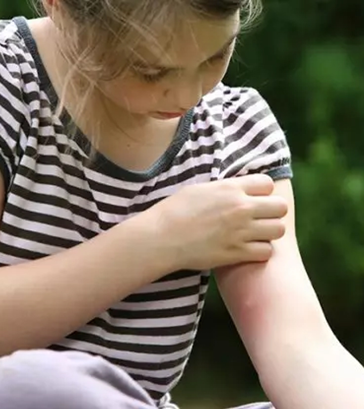 抽搐k Bites In Children: How To Deal With Them