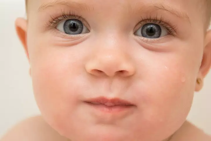 Watery Eyes