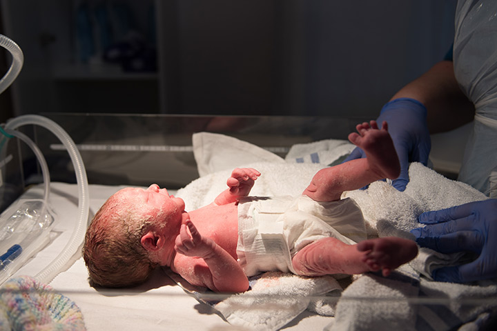 What Are Preterm Births