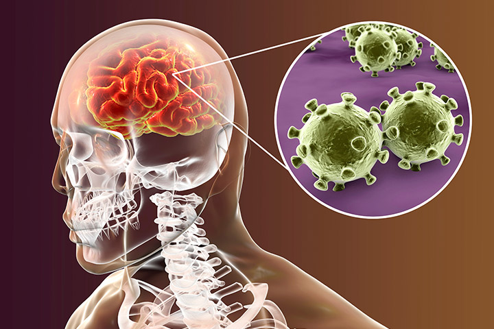 什么是脑膜炎球菌性脑膜炎